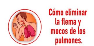flema