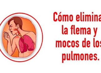 flema