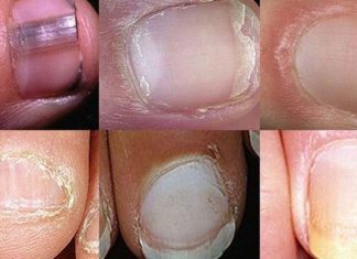 uñas