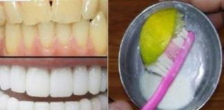 dientes amarillos